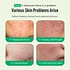 Anti Aging Pads